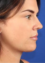 Cosmetic Surgery & Vein Treatment in Springfield, MO