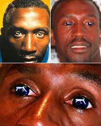 The banned Puma contact lenses worn at the 1996 Olympics by sprinter  Linford Christie The Atlanta Olympics were sponsored by Reebok, who had  paid $40 million for the exclusive rights to the