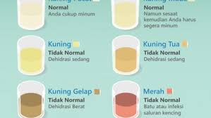 Namun, jika tubuh kita memiliki air. Mengetahui Kondisi Kesehatan Dari Warna Urine Info Sehat Klikdokter Com