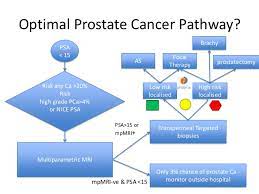 Prostate cancer symptoms can include difficulty urinating, frequent urination, pain while urinating, and a diminished urine stream, but oftentimes there are no signs or symptoms. Prostate Cancer Modernising The Diagnostic Pathway 2013 06 11 By Ma