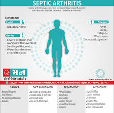 Image result for Septic Joint