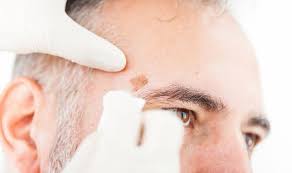 28.04.2021 · skin cancer prevention program now used in 90 nevada schools; Skin Cancer Symptoms Four Signs The Freckles On Your Face Could Be Cancerous Express Co Uk
