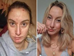 'I Was Paralyzed': Man Recalls Waking Up On Bathroom Floor After A Party