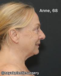 Photos by Dr. L. Mike Nayak (@nayakplasticsurgery) · July 13, 2025