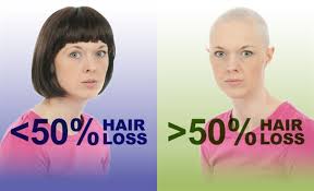 Some chemotherapy drugs are more likely than others to cause hair loss, and different doses can cause anything from a mere thinning to complete baldness. Chemotherapy Induced Alopecia Cia Cancer Therapy Advisor