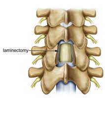 Various authors (mooney & robertson 1976, bogduk 1997) have shown that facet joint pain referral patterns occur predominantly in the buttock and thigh. Procedures Treatments For Facet Syndrome Pain Relief Msi