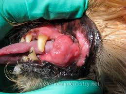 Image result for granuloma gum disease