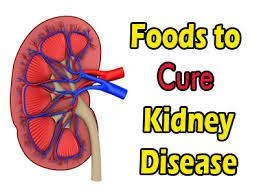 Diet For Stage 4 Chronic Kidney Failure To Eat And To Avoid Kidney Disease Diet Kidney Disease Recipes Chronic Kidney Disease Diet