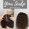 Any area of the scalp with hair loss can be shaded, from the crown to the hairline. 1