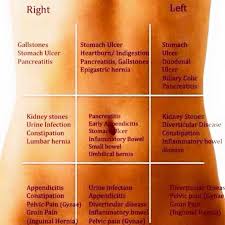 Abdominal Pain Location Chart Www Bedowntowndaytona Com