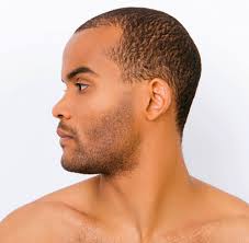Why do beards get ingrown hairs? For The Men How To Get Rid Of Ingrown Hairs Aesthetic Skin Anti Aging Authority