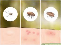How To Identify Insect Bites 15 Steps With Pictures Wikihow