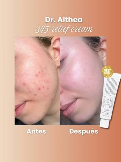 La 345 Relief Cream de Dr. Althea está diseñada para piel sensible o con  tendencia al acné💕 Su fórmula con centella asiática, pantenol y  niacinamida ayuda a calmar la irritación, hidratar en