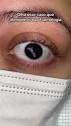 dr adelino monteiro oftalmologista | Discover