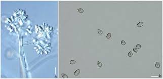 Image result for Botrytis cinerea