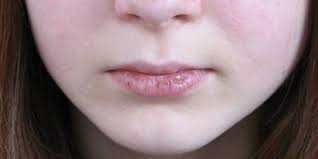 We did not find results for: Penyebab Bibir Pecah Pecah Hingga Berdarah Begini Cara Mengatasinya Merdeka Com