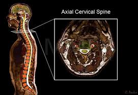 Pin By Larry Chen On Medical Spinal Nerve Spinal Nerve