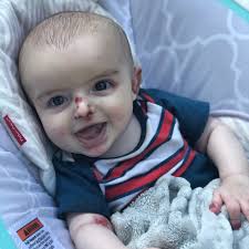 debra of America has teamed up with Maura Ambrose and friends to host the  Carson James Schiraldi Wound Care Supply Drive in loving memory of Maura's  godson, Carson.❤️🦋 This drive celebrates Carson's