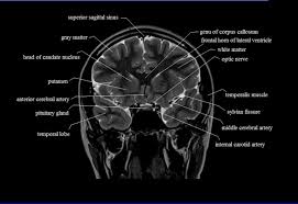 Kl 5739 Mri Brain Diagram Schematic Wiring