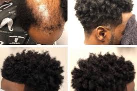 We did not find results for: Lifting The Lid On Male Weaves The Growing Hair Trend For Men Dazed Beauty