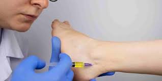 The goal of a cortisone injection is to regulate the immune system when can i return to work and other activities? Cost Of Cortisone Injections Are They Worth It Sport Doctor London