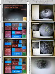 تثبت طابعة hp1102 / atpusties. In Vivo Dynamics Of Retinal Microglial Activation During Neurodegeneration Confocal Ophthalmoscopic Imaging And Cell Morphometry In Mouse Glaucoma Protocol Translated To German