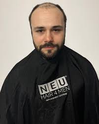 5.5 side part pompadour + razor fade + line up. Mens Hair Systems Male Hair Replacement Systems Online Store