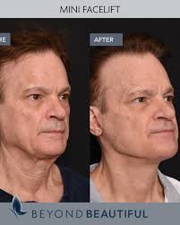 Beyond Beautiful, Dr. Vu Ho...