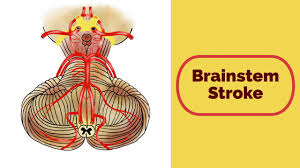 Brainstem nuclei are thus responsible for many of. Brainstem Physiopedia
