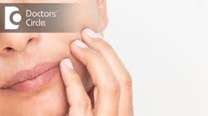 I didn't get any swelling after removal of my upper jaw corner wisdom teeth. Why You Get Swollen Cheeks After Wisdom Teeth Removal Dr Kamalesh Selvam Youtube