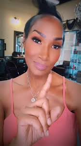 Camish Hopkins Alopecia Dallas