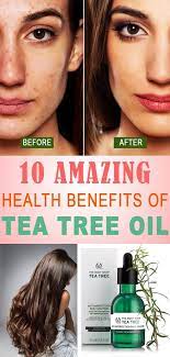 Amazing Tea Tree Oil Benefits Healthy Eon Benefits Tea Tree Oil Teatreeoil Tea Tree Oil Benefits Tea Health Benefits Oil Benefits