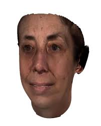 Patient-Reported Outcome Measures in a Facial Reconstruction Case Series  Following the Implementation of an Integrated Craniofac