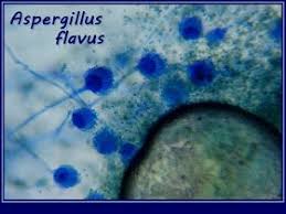 In about 75% cases of otomycosis, aspergillus genus alone is the causative agent. Fun With Microbiology What S Buggin You Aspergillus Flavus Microbiology Lab Microbiology Seriation