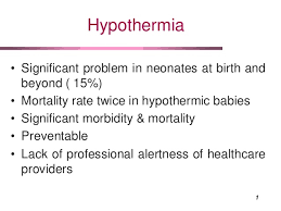 Hypothermia In Newborn