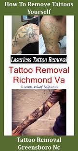 Pin Auf Tattoo Removal