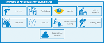 How long does it take to reverse fatty liver disease and what can you do to help speed up recovery? Do All Heavy Drinkers Develop Alcoholic Fatty Liver Disease Afld