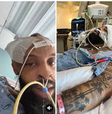 Surviving a stroke with no known cause