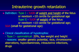 Ppt Oligohydramnios Polyhydramnios And Intrauterine Growth Retardation Powerpoint Presentation Id 6117102