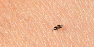 Maybe you would like to learn more about one of these? These Bugs Usually Kill Pests But This Time Of Year They Bite Us