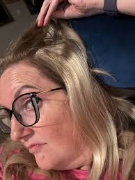 Can I fix dark hair to blonde before wedding?