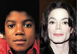 Why did Michael Jackson cover up his skin disease with white makeup instead  of brown makeup?