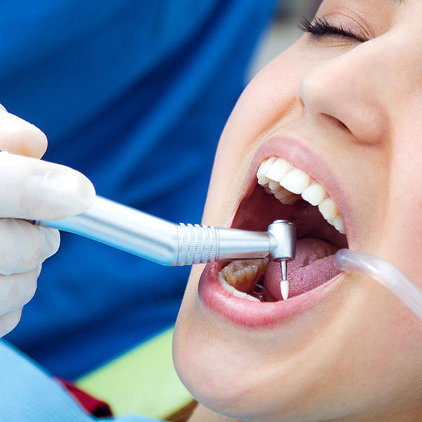 Root Canal product image