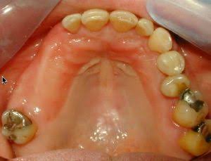 Why Replace Missing Teeth? | Why Replace Missing Teeth? - Kazemi Oral  Surgery | Facialart.com