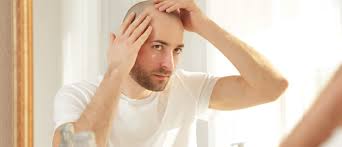 The menopausal transition is the time leading up to menopause and can last several years. Will There Be A Permanent Cure For Baldness Manual