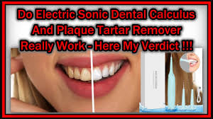 How to remove dental calculus. Do Electric Sonic Dental Calculus And Plaque Tartar Remover Really Work Here My Verdict Youtube