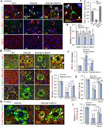 Targeting the overexpressed mitochondrial protein VDAC1 in a mouse model of  Alzheimers disease protects against mitochondrial dysfunction and  mitigates brain pathology | Translational Neurodegeneration | Full Text