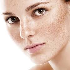 Pigmentation Treatment Dubai | Hyperpigmentation Treatment