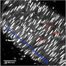 In addition, the contractile state of smooth muscle is controlled by hormones, autocrine/paracrine agents, and other local chemical signals. The Organisation Of Vascular Smooth Muscle Cells A Quantitative Fast Fourier Transform Fft Based Assessment Sciencedirect