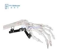 Multiplanar Minirail External Fixator Orthofix Type Mini ...